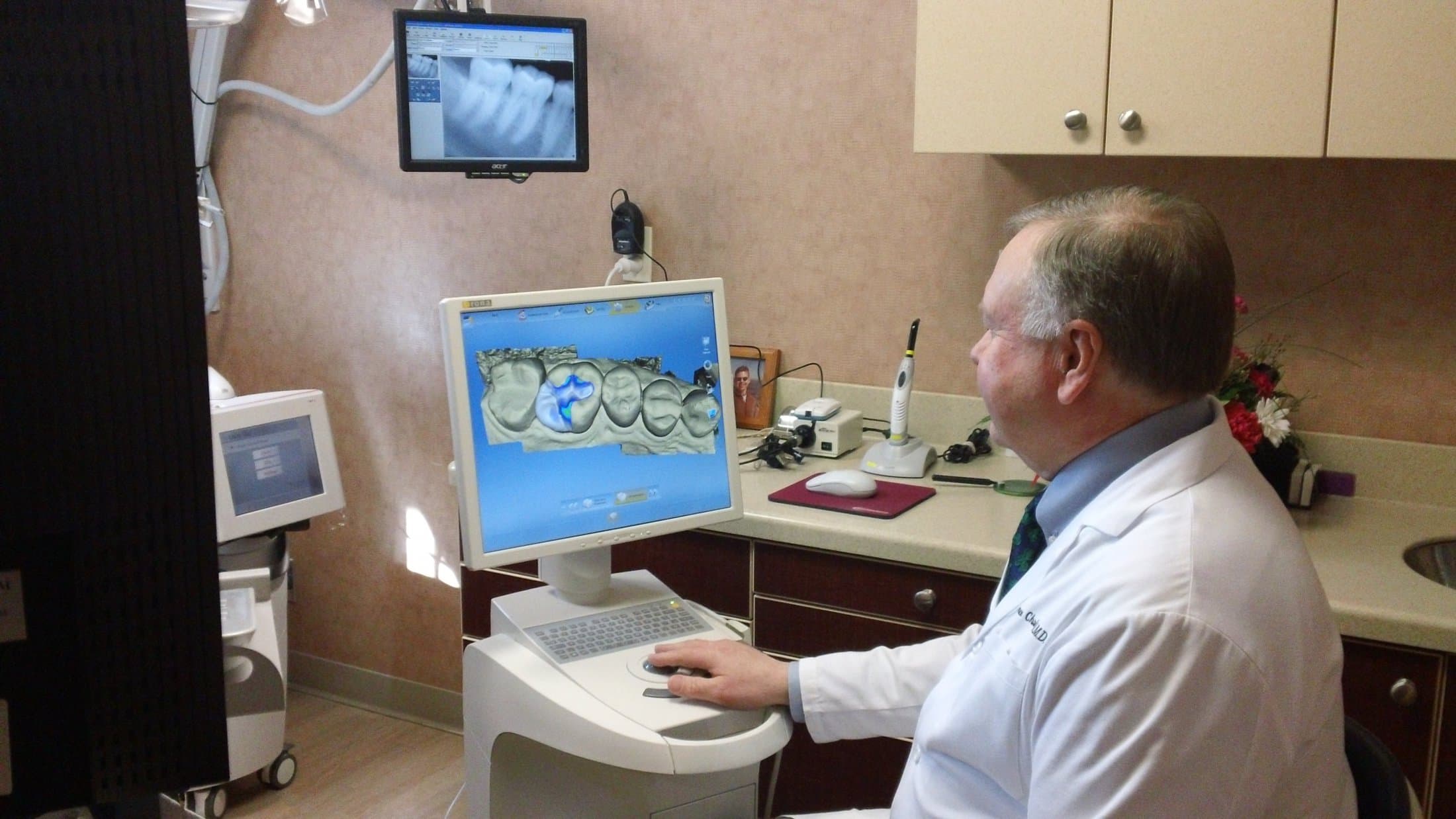 A dentist designing a CEREC same-day crown for a cosmetic restoration
